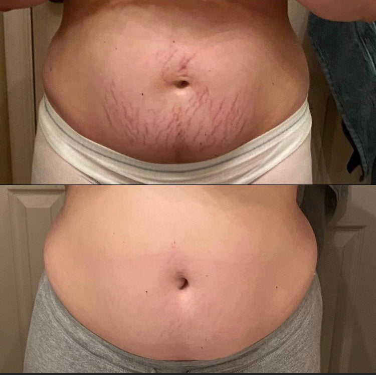 *Memorial Day Sale BODY "BUG" BUTTER
