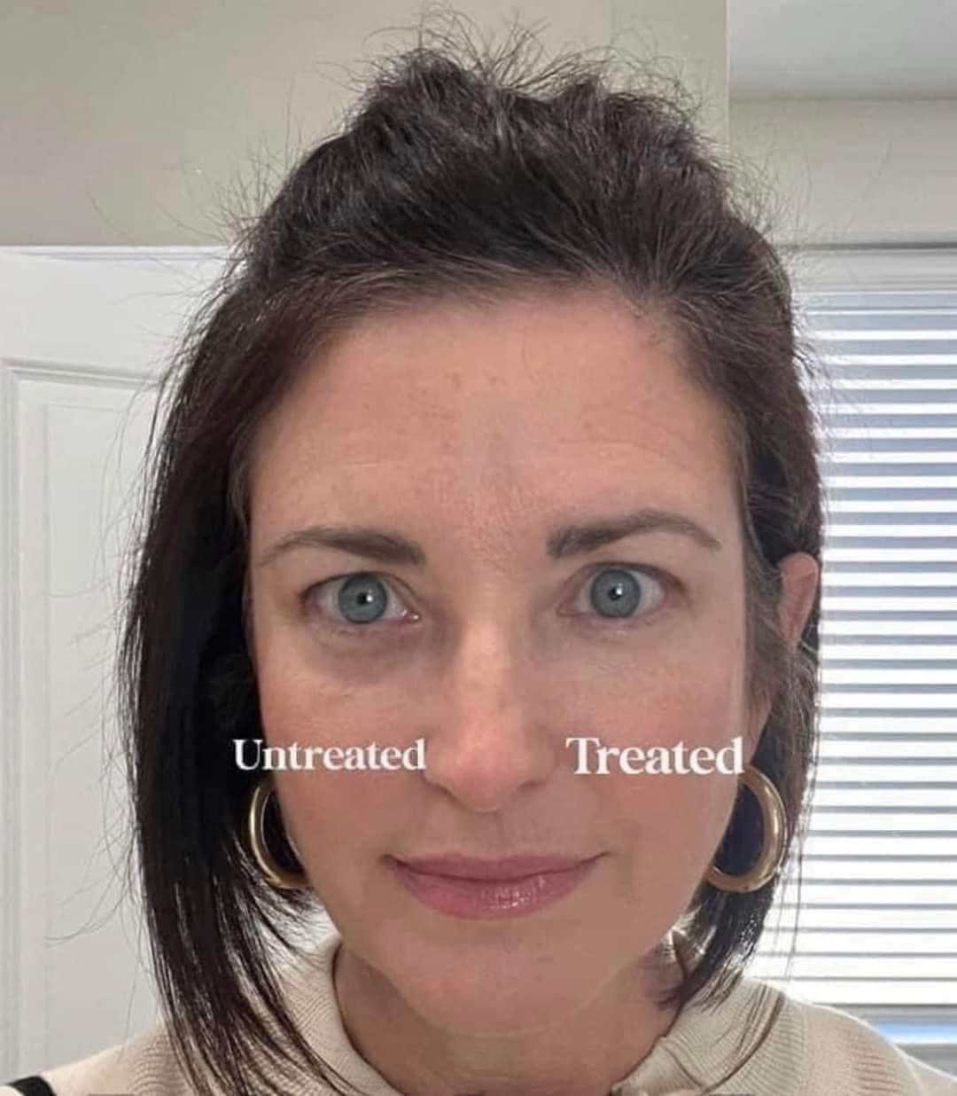Nutricentials® Eye Love Bright Eyes