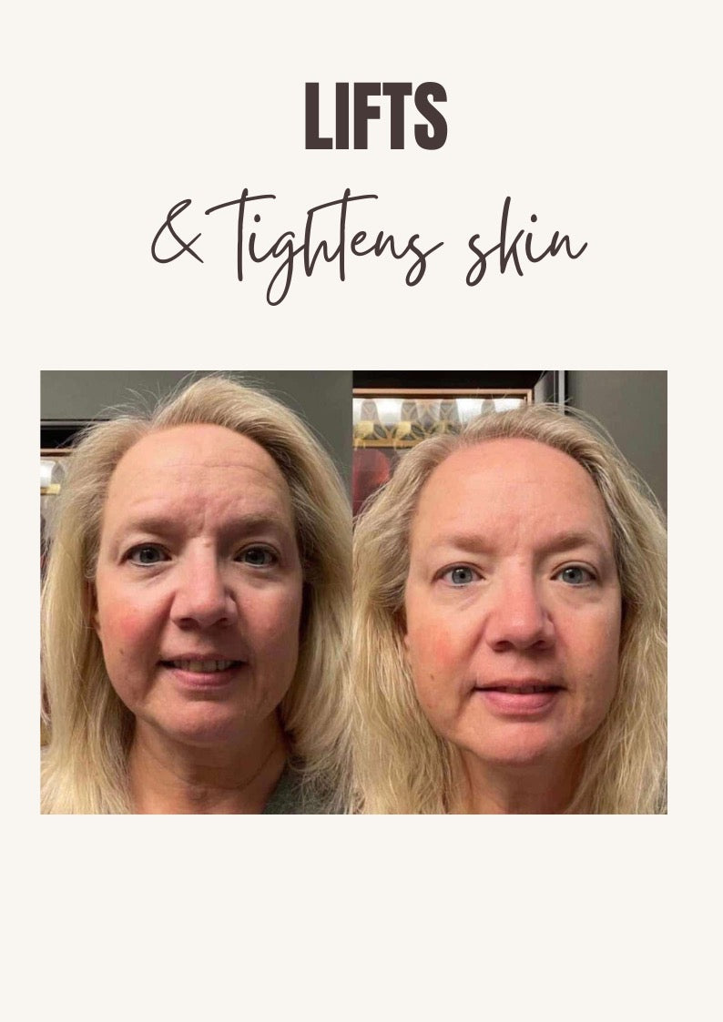 NEW Improved Uplift Cream