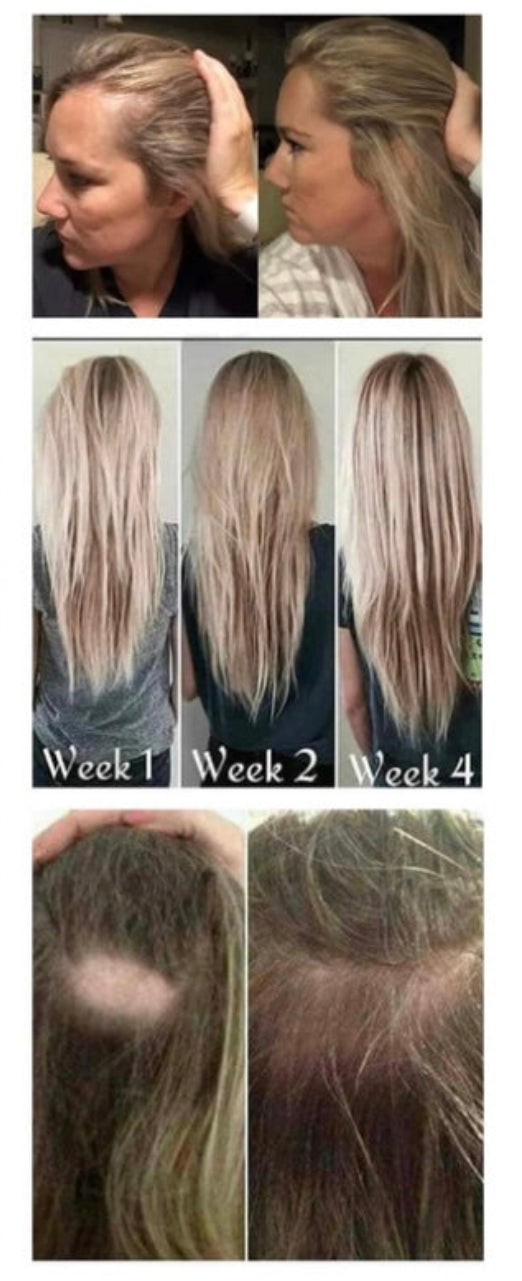 ageLOC Scalp & Hair Serum